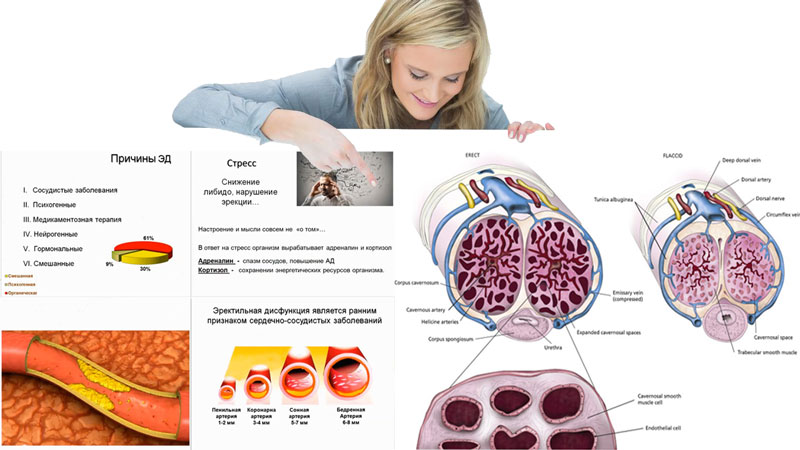 Лечение эректильной дисфункции у мужчин